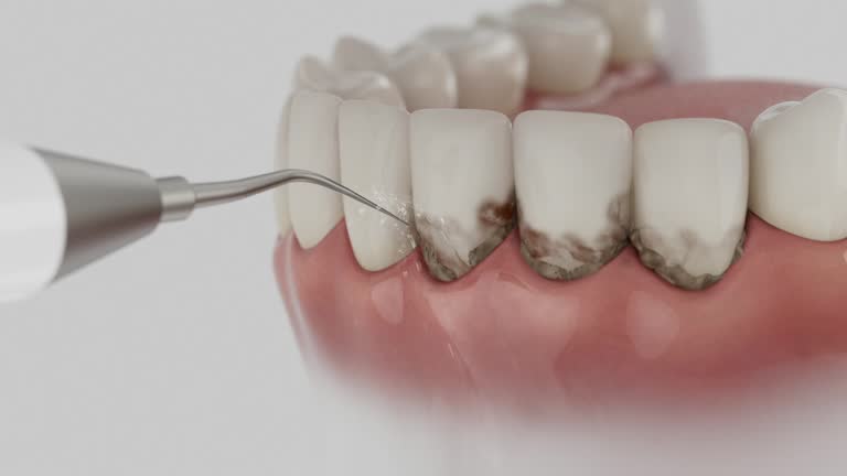Trusted Wisdom Tooth Removal service in Burnham, PA - Dentist Open Now